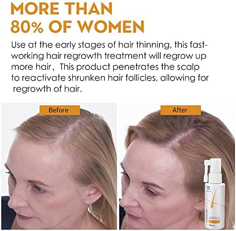 Бърз спрей за растежа на косата от загуба на течност с етерично масло за мъже и жени, копър за растежа на косата, серум за грижа