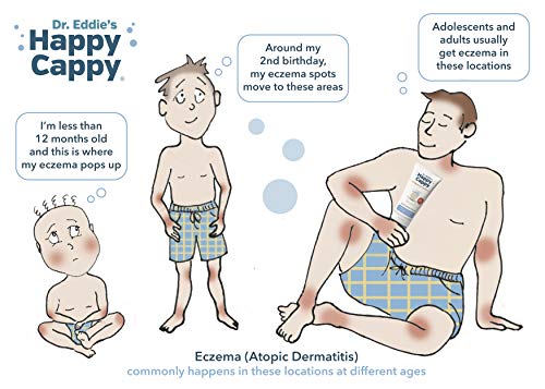 Хидратиращ крем Happy Cappy | За грижа за Суха, Сърбеж, Чувствителна кожа, склонна към Екзема, за всички възрасти, за лечение на