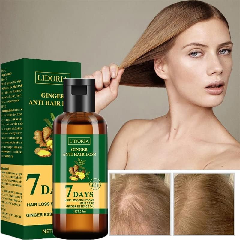 Етерично масло от джинджифил за растежа на косата, средство за защита срещу загуба на коса, бързо развиващи се, които плешивост,